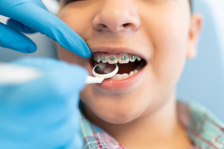 9 Soft Snacks for Kids with Braces The Super Dentists