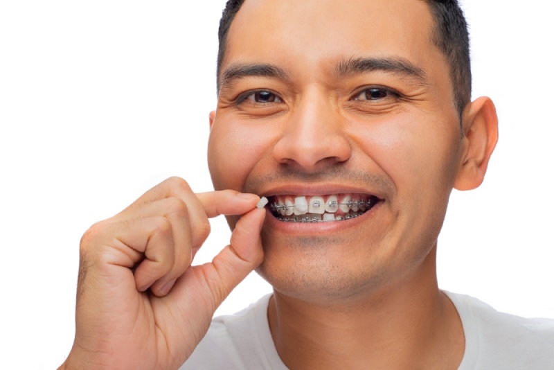 Man applies dental wax to braces