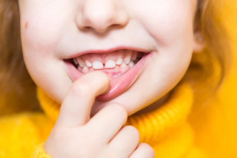 Close-up of a young caucasian girl with an overbite